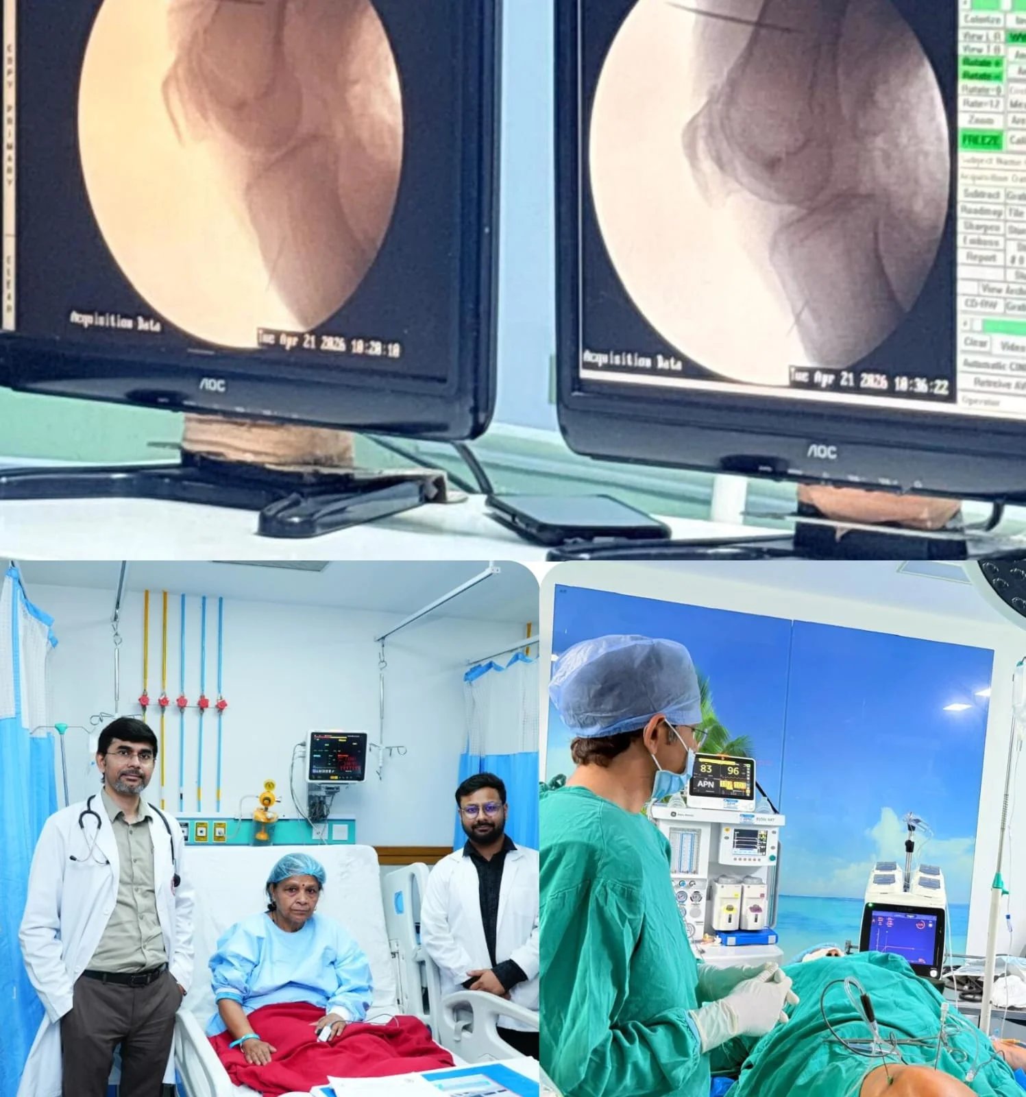 श्री महंत इन्दिरेश अस्प्ताल में बिना सर्जरी घुटने के दर्द का सफल उपचार